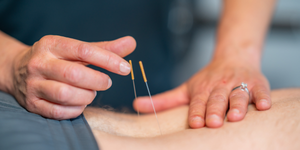 Dry Needling Fysio Totaal Waalwijk